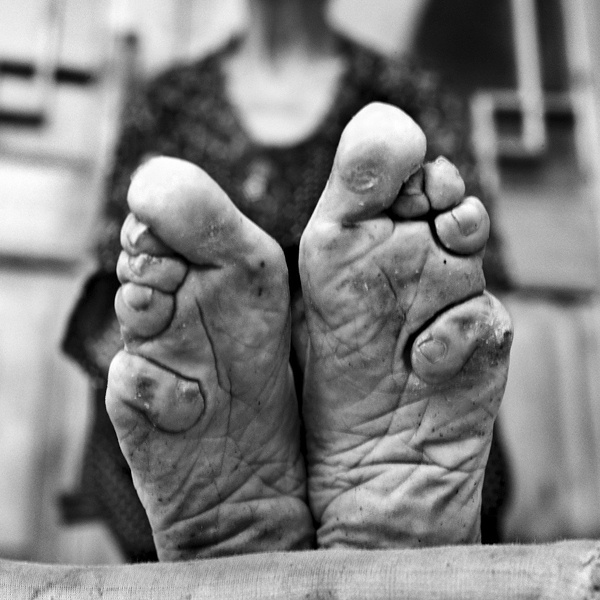 Chinese foot binding body modification practice creating lotus feet as beauty standard and status symbol Chinese foot binding body modification practice creating lotus feet as beauty standard and status symbol